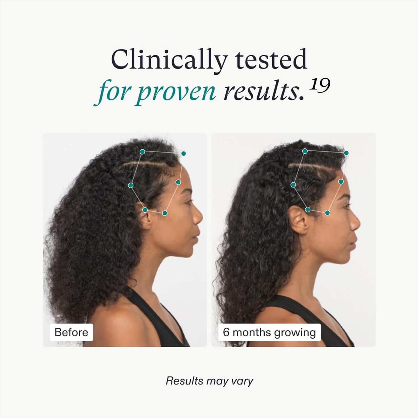 Nutrafol Women's Vegan Hair Growth Supplements, Plant-based, For Women 18-44 Years Old, Clinically Tested for Visibly Thicker, Stronger Hair, Dermatologist Recommended - 1 Month Supply
